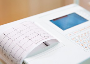 Na czym polega badanie EKG?